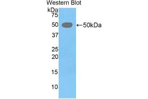 Western blot analysis of the recombinant protein. (LEFTY1 antibody  (AA 169-368))
