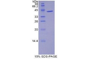 SDS-PAGE (SDS) image for WAP Four-Disulfide Core Domain 5 (WFDC5) (AA 1-126) protein (His tag,GST tag) (ABIN1821733)
