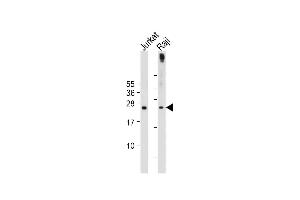 All lanes : Anti-hPHO1-M1 at 1:2000 dilution Lane 1: Jurkat whole cell lysate Lane 2: Raji whole cell lysate Lysates/proteins at 20 μg per lane. (Phosphate Transporter PHO1 (AA 1-30), (N-Term) antibody)