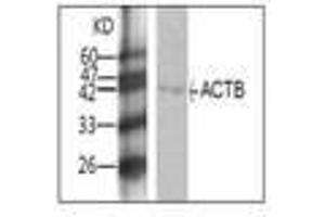 Image no. 1 for anti-Actin, beta (ACTB) antibody (ABIN791504) (beta Actin antibody)