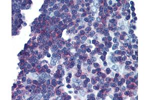 Anti-LAT antibody IHC of human thymus. (LAT antibody  (Cytoplasmic Domain))