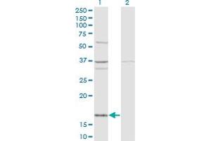 Western Blot analysis of FAU expression in transfected 293T cell line by FAU monoclonal antibody (M03), clone 3C10.