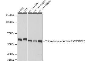 Western blot analysis of extracts of various cell lines, using Thioredoxin reductase 2 (Thioredoxin reductase 2 (TXNRD2 ) ) Rabbit mAb (ABIN7270807) at 1:1000 dilution. (TXNRD2 antibody)