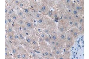 IHC-P analysis of Human Liver Tissue, with DAB staining. (MMP15 antibody  (AA 280-497))