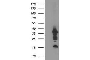 HEK293T cells were transfected with the pCMV6-ENTRY control (Left lane) or pCMV6-ENTRY PDLIM2 (Right lane) cDNA for 48 hrs and lysed. (PDLIM2 antibody)