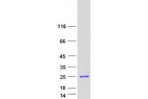 Western Blotting (WB) image for High Mobility Group AT-Hook 1 (HMGA1) (Transcript Variant 6) protein (Myc-DYKDDDDK Tag) (ABIN2722742)