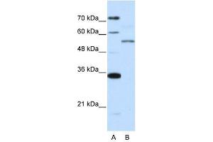 ZNF707 antibody used at 0.