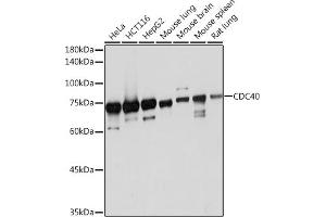 Western blot analysis of extracts of various cell lines, using CDC40 Rabbit mAb (ABIN7266255) at 1:1000 dilution.