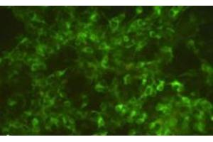 Fluorescence image of a culture of SiMa human neuroblastoma cells, pretreated for 12 h with 10 μg/ml of α-CJe, and after fixation stained for TH, revealing an intense cytoplasmic labeling in most of the cells (Campylobacter jejuni antibody)