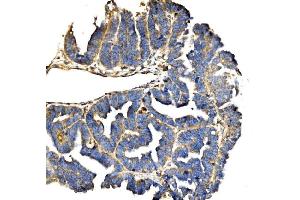 IHC analysis of Elongin-C/ELOC using anti-Elongin-C/ELOC antibody (ABIN7598951).