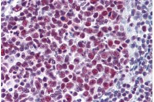 Immunohistochemistry (Formalin-fixed Paraffin-embedded Sections) (IHC (fp)) image for anti-Small Nuclear Ribonucleoprotein Polypeptide A (SNRPA) (AA 1-283) antibody (ABIN574344)