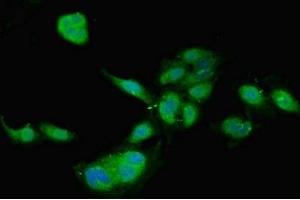 Immunofluorescent analysis of Hela cells using ABIN7159497 at dilution of 1:100 and Alexa Fluor 488-congugated AffiniPure Goat Anti-Rabbit IgG(H+L) (TIMP4 antibody  (AA 31-224))