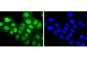 Immunofluorescence (Cultured Cells) (IF (cc)) image for anti-Protein Kinase C, alpha (PKCa) (pThr638) antibody (ABIN5557396)