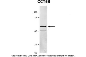 Sample Type: HEK 293 (10ug)Primary Dilution: 1:1000Secondary Antibody: conjugated goat anti-rabbitSecondary Dilution: 1:10,000Image Submitted By: Amy GrayBrigham Young University (Importin 5 antibody  (N-Term))