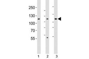 Western blot analysis of lysate from 1) HT-29, 2) HeLa, and 3) Jurkat cell line using JAK1 antibody