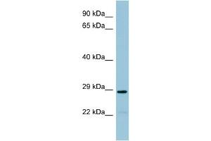 WB Suggested Anti-NAT8B Antibody Titration:  0. (NAT8B antibody  (Middle Region))
