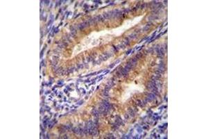 Immunohistochemistry (Paraffin-embedded Sections) (IHC (p)) image for anti-Prostaglandin-Endoperoxide Synthase 2 (Prostaglandin G/H Synthase and Cyclooxygenase) (PTGS2) (AA 370-399), (Middle Region) antibody (ABIN951767)