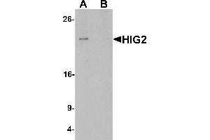 Western blot analysis of HIG2 in 3T3 cell lysate with HIG2 antibody at 1 µg/mL in (A) the absence and (B) the presence of blocking peptide. (HILPDA antibody  (C-Term))