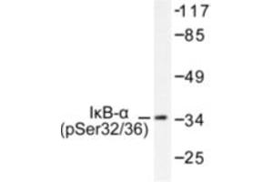 Image no. 1 for anti-Nuclear Factor of kappa Light Polypeptide Gene Enhancer in B-Cells Inhibitor, alpha (NFKBIA) (pSer32), (pSer36) antibody (ABIN318052) (NFKBIA antibody  (pSer32, pSer36))