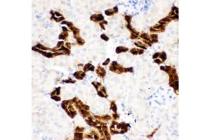 Anti-Calbindin Picoband antibody,  IHC(P): Mouse Kidney Tissue (CALB1 antibody  (AA 2-175))
