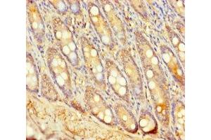 Immunohistochemistry of paraffin-embedded human small intestine tissue using ABIN7174635 at dilution of 1:100 (UGT2A3 antibody  (AA 201-491))