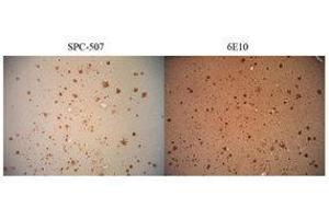 Immunohistochemistry (IHC) image for anti-Amyloid beta (A4) Precursor Protein (APP) antibody (ABIN6655141)