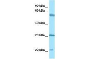 Image no. 1 for anti-Brain-Enriched Guanylate Kinase-Associated (BEGAIN) (AA 273-322) antibody (ABIN6748420) (BEGAIN antibody  (AA 273-322))