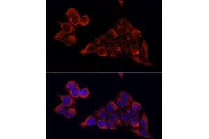 Immunofluorescence analysis of HeLa cells using MTOR antibody. (MTOR antibody  (AA 2400-2500))