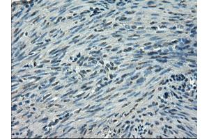 Immunohistochemical staining of paraffin-embedded endometrium tissue using anti-SLC2A5mouse monoclonal antibody. (SLC2A5 antibody)