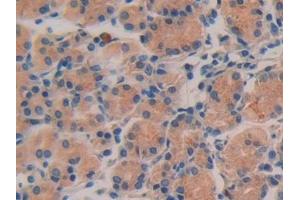 Detection of IL16 in Human Stomach Tissue using Polyclonal Antibody to Interleukin 16 (IL16) (IL16 antibody  (AA 1203-1332))