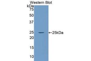 Western blot analysis of the recombinant protein. (LAMa4 antibody  (AA 832-1039))