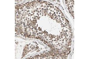Immunohistochemical staining of human testis with ZNF37A polyclonal antibody  shows cytoplasmic positivity in cells of seminiferus ducts at 1:20-1:50 dilution. (ZNF37A antibody)