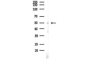 anti-Iroquois Homeobox Protein 5 (IRX5) antibody