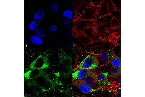 Immunocytochemistry/Immunofluorescence analysis using Mouse Anti-Nav1. (Nav1.8 antibody  (AA 1724-1956))