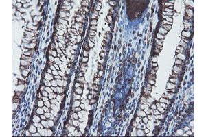 Image no. 2 for anti-SKI-Like Oncogene (SKIL) (AA 307-684) antibody (ABIN1491380) (SKIL antibody  (AA 307-684))