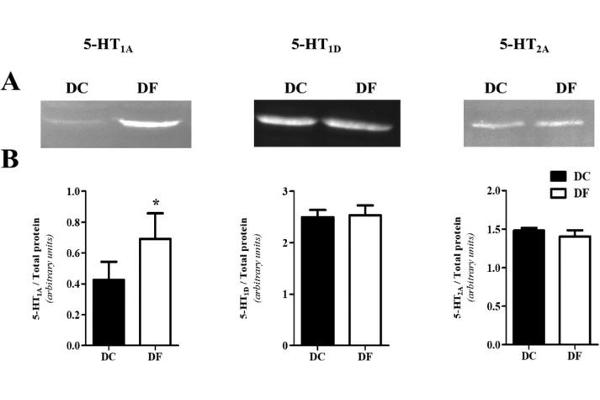 Serotonin Receptor 1A antibody  (AA 301-400)