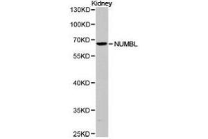 Western Blotting (WB) image for anti-Numb Homolog (Drosophila)-Like (NUMBL) antibody (ABIN1873987)