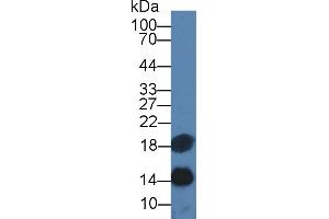 Western blot analysis of Rat Pancreas lysate, using Rat TFF2 Antibody (2 µg/ml) and HRP-conjugated Goat Anti-Mouse antibody ( (Renin antibody  (AA 275-389))