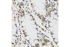 Immunohistochemistry of paraffin-embedded human colon using C antibody (ABIN6127552, ABIN6137952, ABIN6137953 and ABIN6216977) at dilution of 1:100 (40x lens). (CASC5 antibody  (AA 1-300))