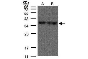 Western Blotting (WB) image for anti-Heterogeneous Nuclear Ribonucleoprotein A1 (HNRNPA1) antibody (ABIN2856277)