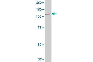 EEF2K MaxPab polyclonal antibody. (EEF2K antibody  (AA 1-725))