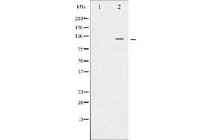 Western blot analysis of Catenin-β expression in 293 whole cell lysates,The lane on the left is treated with the antigen-specific peptide. (CTNNB1 antibody  (N-Term))