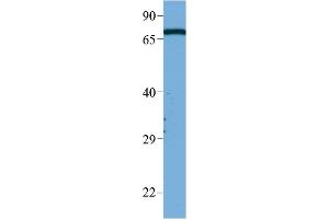 WB Suggested Anti-Masp2 Antibody Titration:  1 ug/ml  Sample Type:  HeLa (MASP2 antibody  (Middle Region))