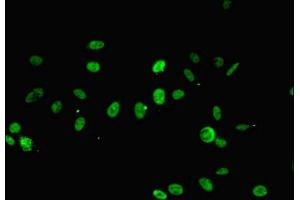 Immunofluorescent analysis of Hela cells using ABIN7167697 at dilution of 1:100 and Alexa Fluor 488-congugated AffiniPure Goat Anti-Rabbit IgG(H+L) (RPA2 antibody  (AA 1-267))