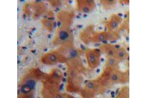 Used in DAB staining on fromalin fixed paraffin-embedded Liver tissue (Caspase 7 antibody  (AA 24-198))