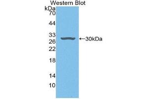 Western Blotting (WB) image for anti-Hepatoma-Derived Growth Factor (HDGF) (AA 10-240) antibody (ABIN1868349) (HDGF antibody  (AA 10-240))
