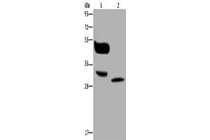 Gel: 10 % SDS-PAGE, Lysate: 40 μg, Lane 1-2: A375 cells, human lung cancer tissue, Primary antibody: ABIN7130137(MAGEA8 Antibody) at dilution 1/400, Secondary antibody: Goat anti rabbit IgG at 1/8000 dilution, Exposure time: 30 seconds (MAGEA8 antibody)