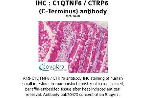 Image no. 1 for anti-Complement C1q Tumor Necrosis Factor-Related Protein 6 (C1QTNF6) antibody (ABIN1732486) (CTRP6 antibody)