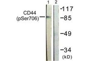 Western blot analysis of extracts from NIH-3T3 cells treated with PMA 250ng/ml 5', using CD44 (Phospho-Ser706) Antibody. (CD44 antibody  (pSer706))