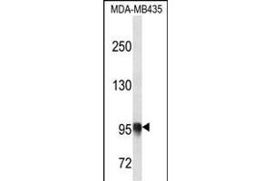 PLOD3 Antibody (N-term) (ABIN656661 and ABIN2845902) western blot analysis in MDA-M cell line lysates (35 μg/lane).